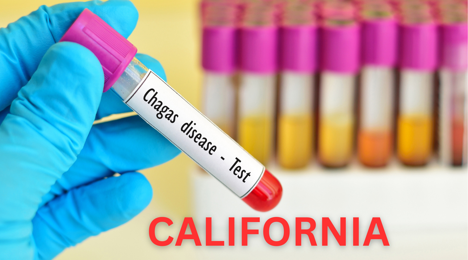 COVID-193 Chagas Disease in California: Your Guide to Risks, Symptoms, and Prevention