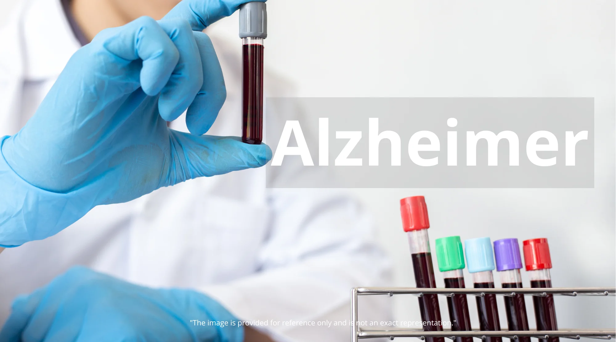 New Alzheimer's Blood Test Could Revolutionize Diagnosis: A Detailed Guide - Alzheimer's blood test