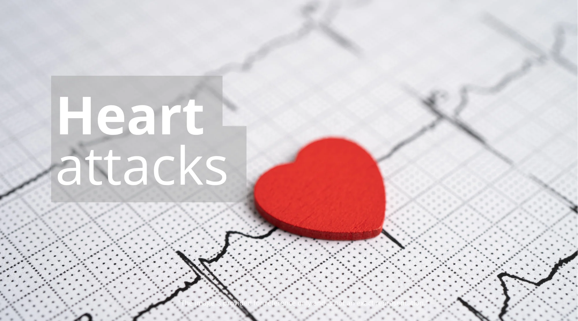 Clogged Arteries: Unveiling the Causes, Risks, and Proven Prevention Strategies - Clogged Arteries