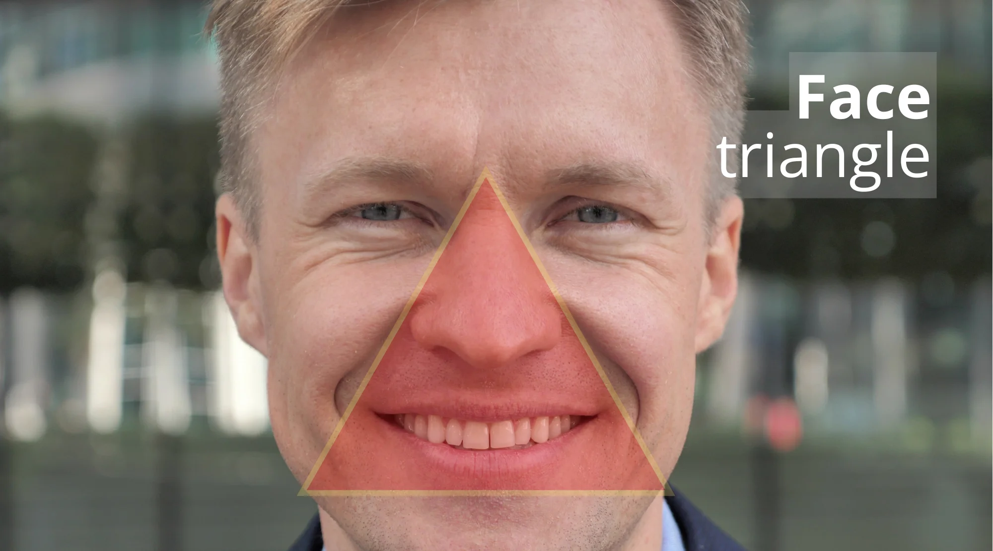 The Danger Triangle of the Face: Risks, Prevention, and How to Protect Your Health - danger triangle of the face