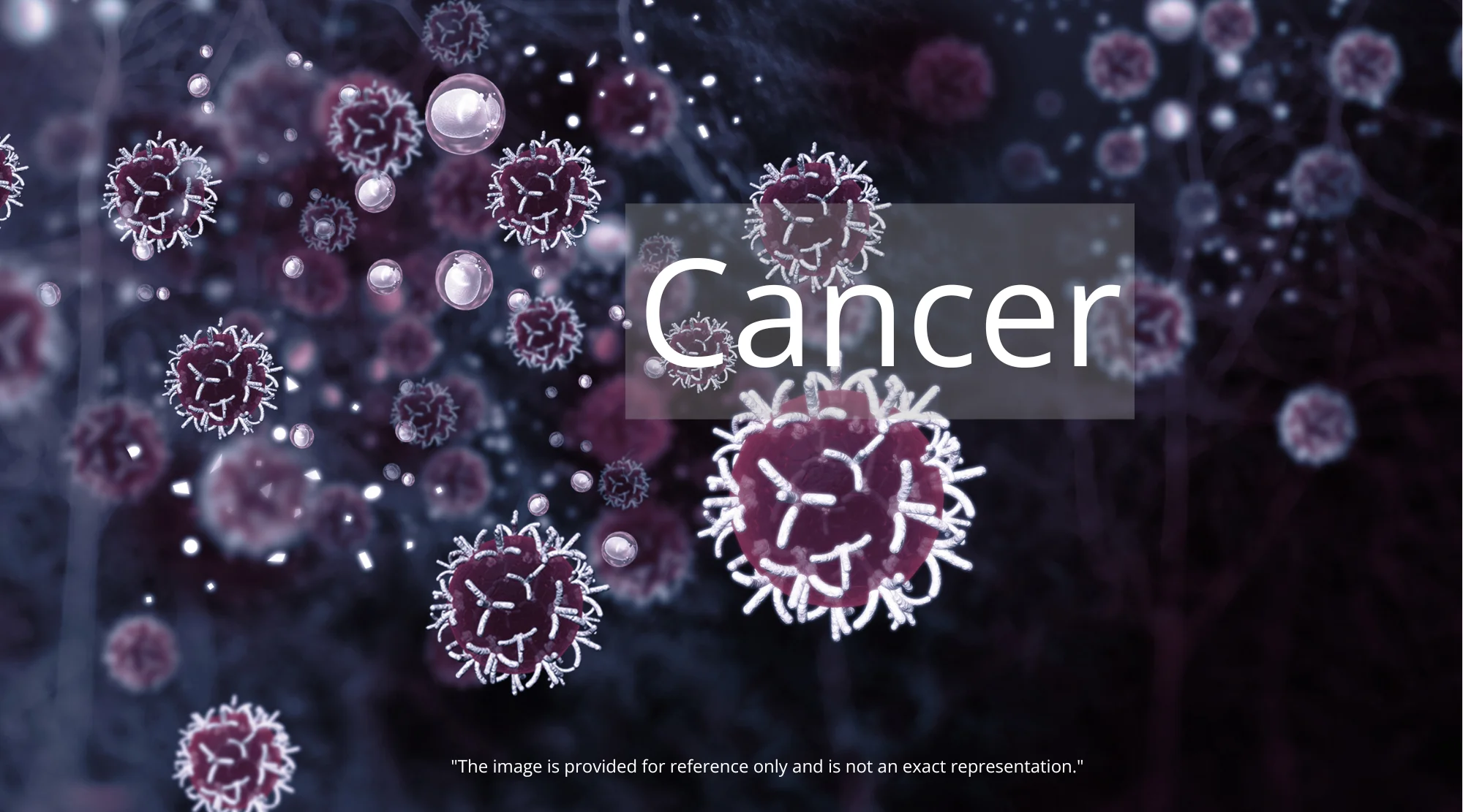 Head and Neck Squamous Cell Carcinoma - detail 1