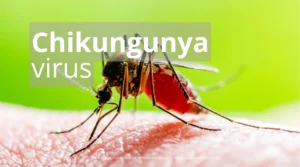 Chikungunya Virus: US Guide to Prevention, Symptoms & Treatment - Chikungunya Virus