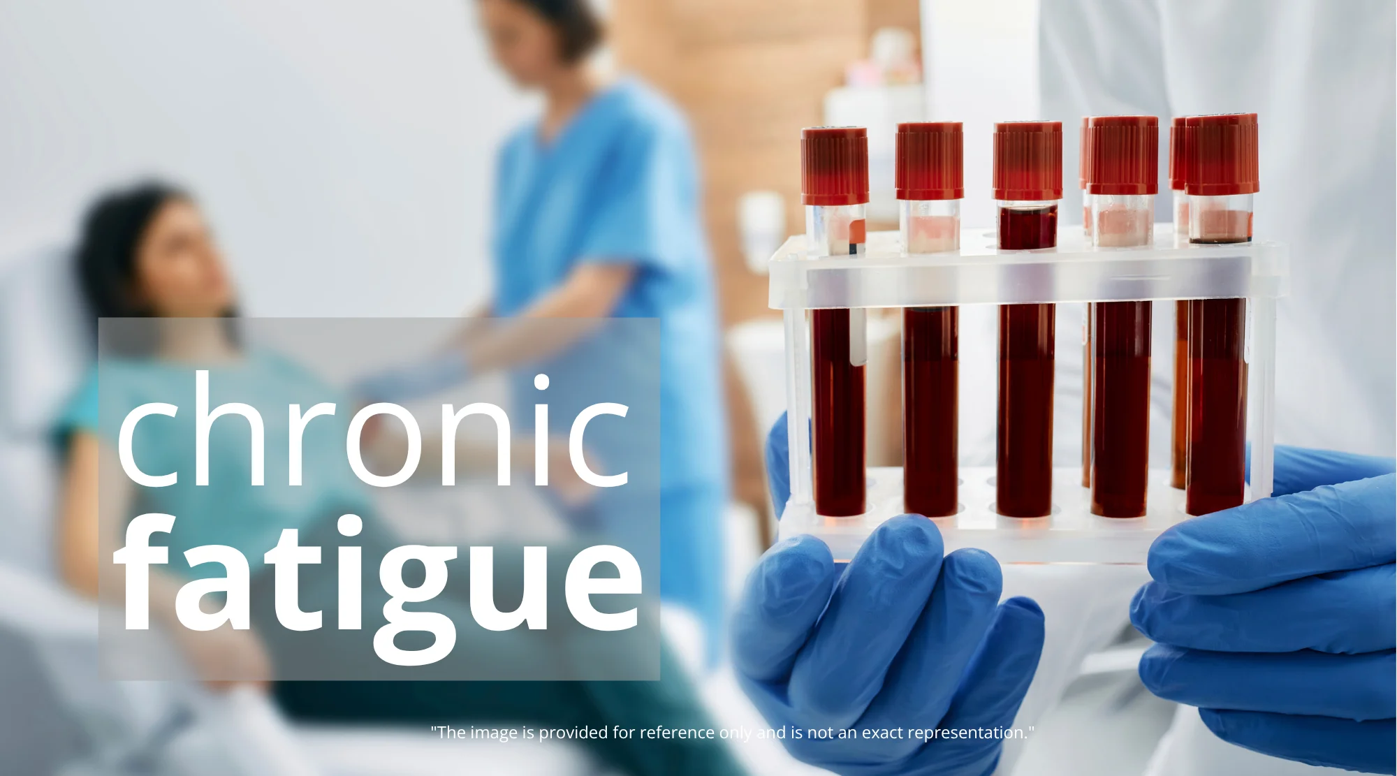 chronic-fatigue-syndrome-c2h6ov Breakthrough Blood Test Offers Hope for Chronic Fatigue Syndrome Diagnosis