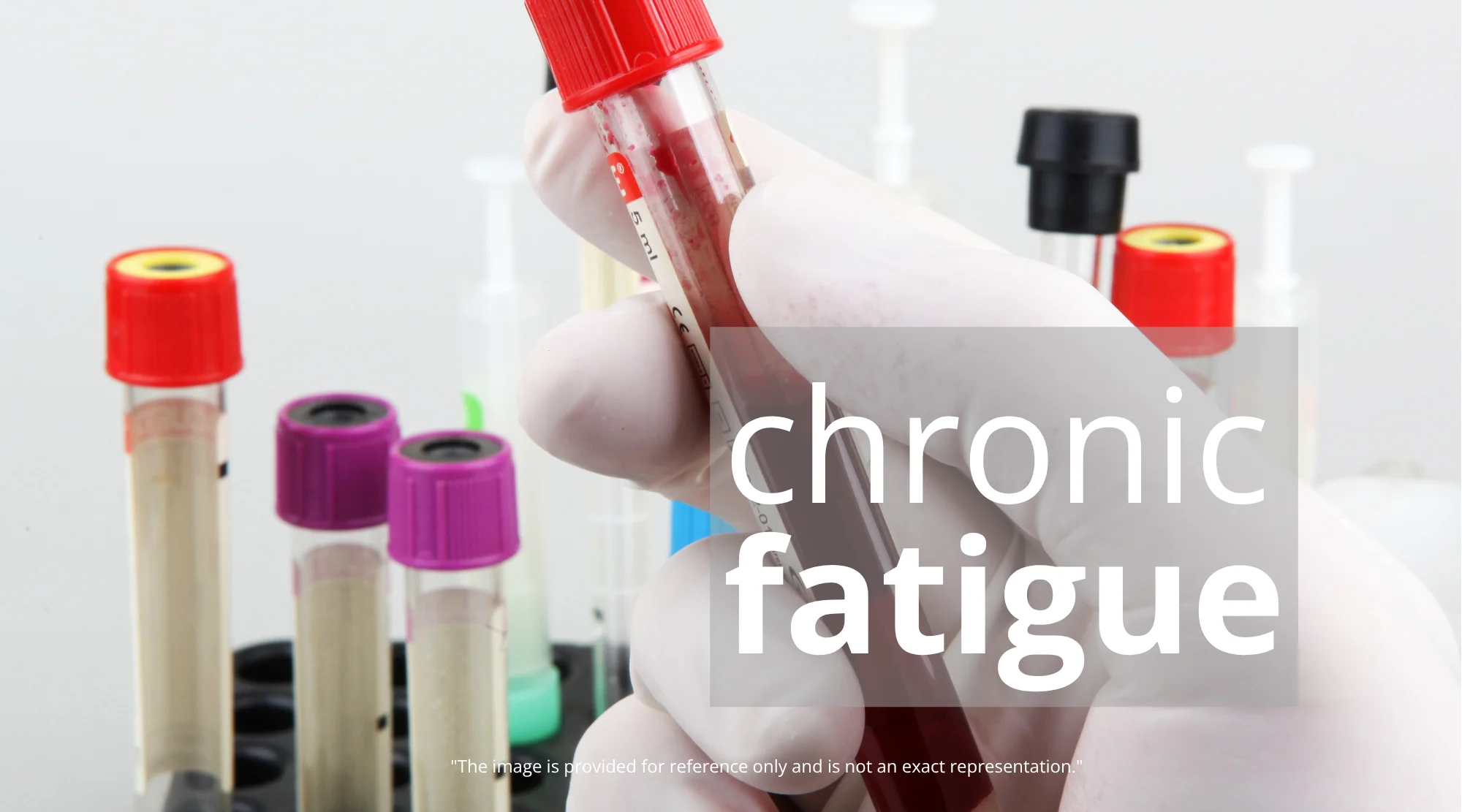 Breakthrough Blood Test Offers Hope for Chronic Fatigue Syndrome Diagnosis - Chronic Fatigue Syndrome